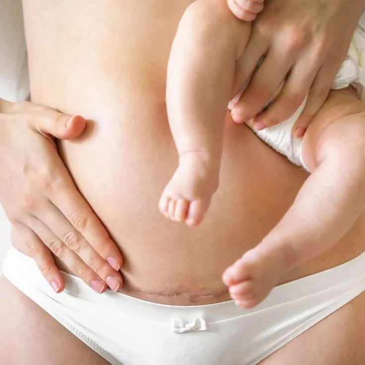 After Delivery Massage